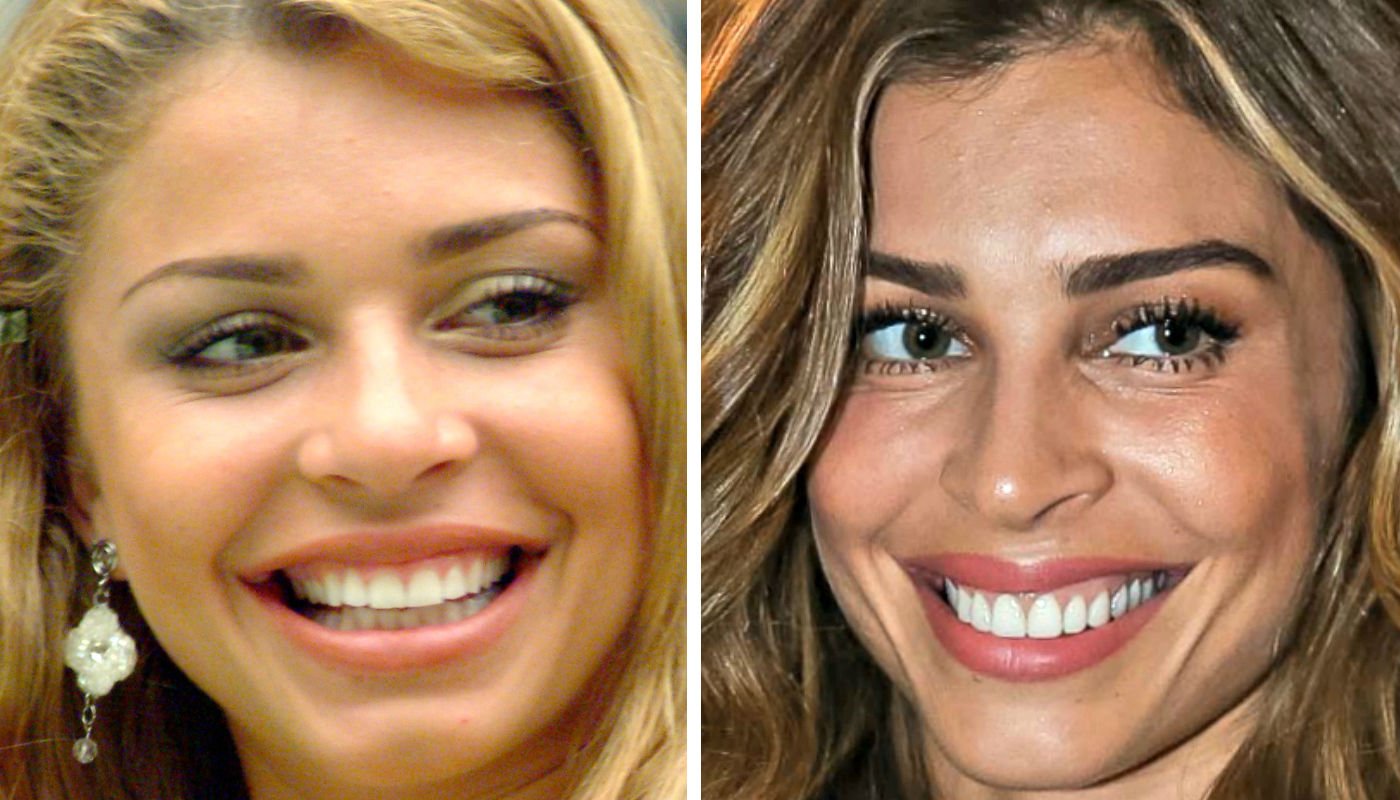 Como são os dentes naturais das famosas: antes e depois de Grazi, Juliana  Paes e mais - Mulher