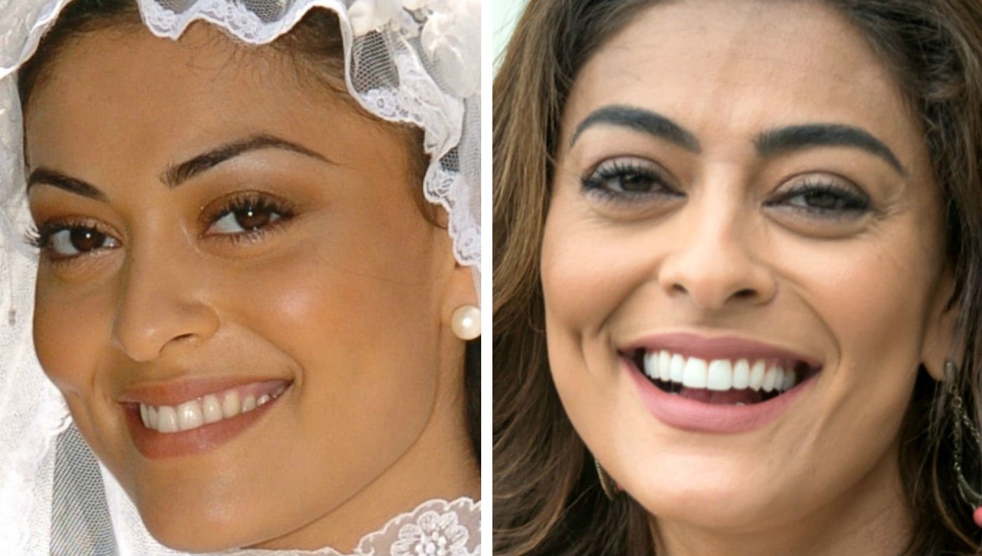 Como são os dentes naturais das famosas: antes e depois de Grazi, Juliana  Paes e mais - Mulher